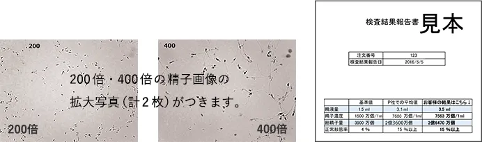 200倍・400倍の精子画像の拡大写真(計2枚)がつきます。